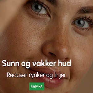 Hues Skin i 30 dager for kun 149 kr